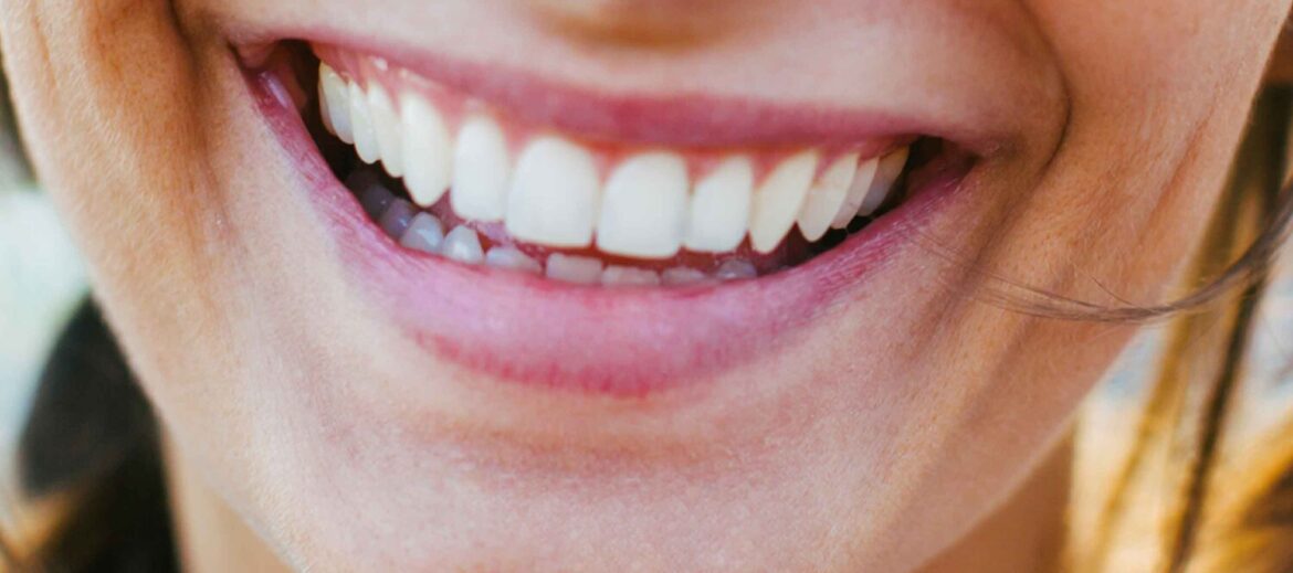 Top 3 Preps You Must Do Before Visiting A Cosmetic Dentist in Sydney